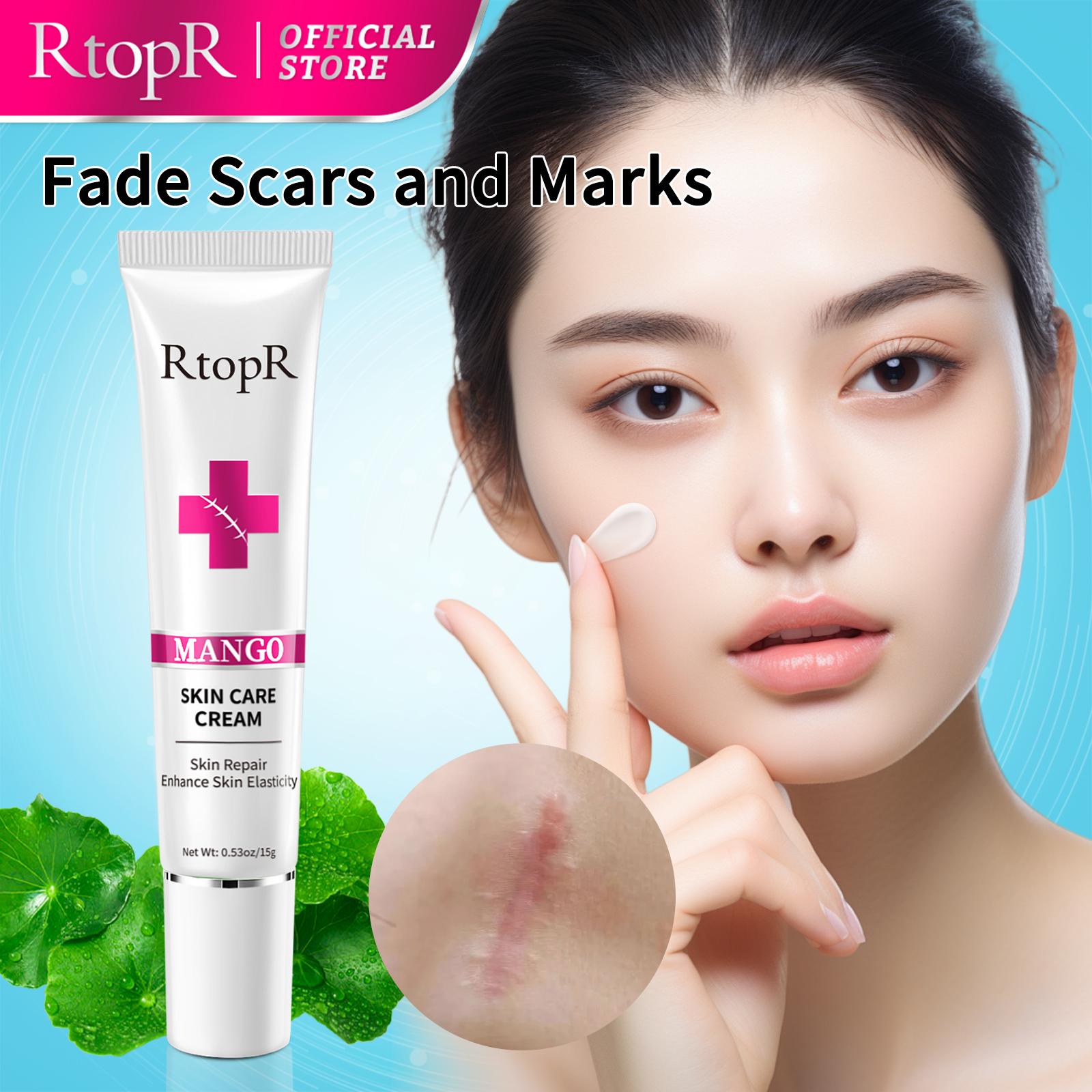 RtopR Acne Removal Cream - Spot Removal & Skin Repair 15g